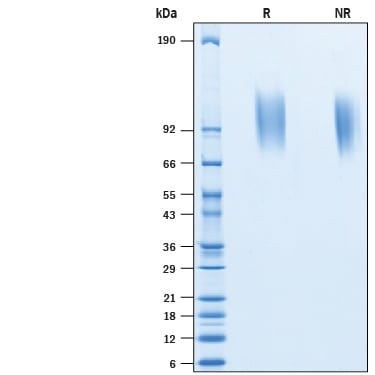 Recombinant Human Mer His-tag Protein SDS-PAGE