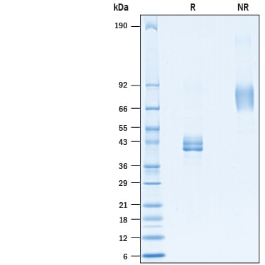 Recombinant Cynomolgus Monkey Ly6E Fc Chimera Protein SDS-PAGE