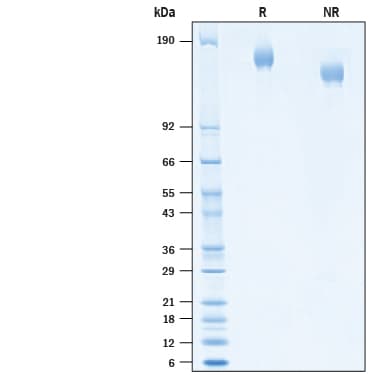 SDS-PAGE gel of purified recombinant SARS-CoV-2 Spike protein
