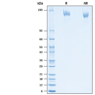 Recombinant SARS-CoV-2 Spike (GCN4-IZ) His Protein SDS-PAGE