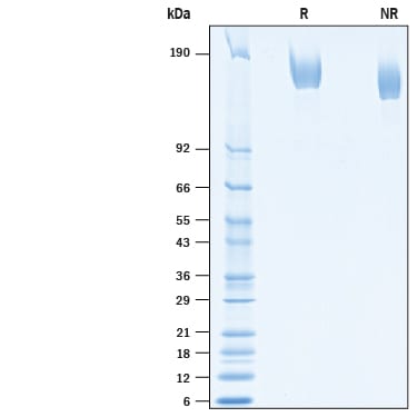 Recombinant SARS-CoV-2 Spike His-tag Protein SDS-PAGE