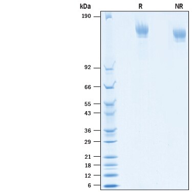 Recombinant SARS-CoV-2 D614G Spike His-tag, Protein CF SDS-PAGE