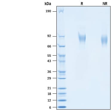 SDS-PAGE gel of purified recombinant SARS-CoV-2 Spike S2 Domain protein with His-tag