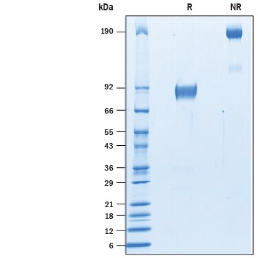 Recombinant Mouse SIRP beta 1a Fc Chimera Protein SDS-PAGE