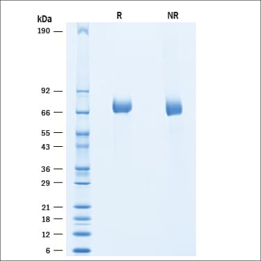 SDS-PAGE gel picture of purified Recombinant Human IL-4I1 Protein