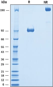 Recombinant Mouse 5T4 Fc Chimera Protein SDS-PAGE
