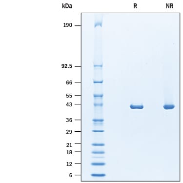 Recombinant Human ACAT1 Protein His-tag Protein SDS-PAGE