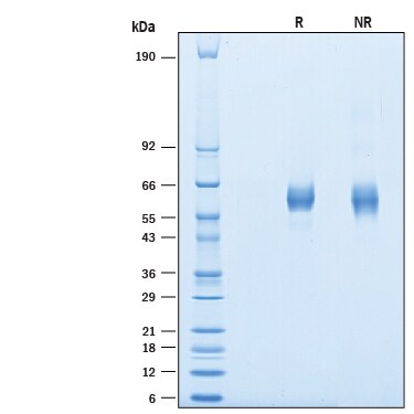 Recombinant Human APCDD1 His-tag Protein SDS-PAGE