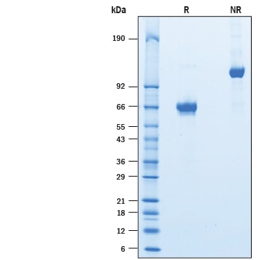 Recombinant Human ASGR1/ASGPR1 Fc Chimera Protein SDS-PAGE