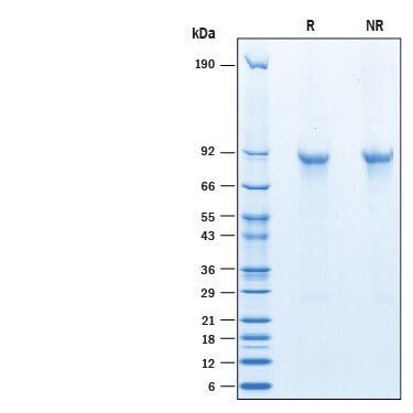 Recombinant Mouse ANGPTL8/Betatrophin His-tag Protein SDS-PAGE