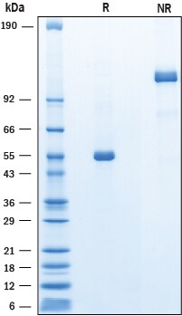 Recombinant Mouse ANGPTL8/Betatrophin Fc Chimera Protein SDS-PAGE