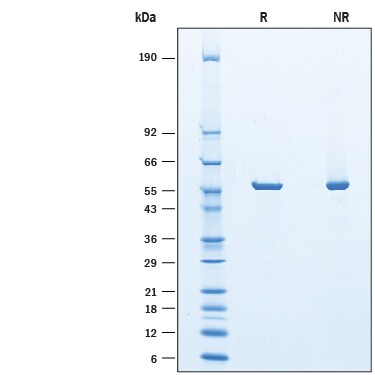Recombinant Guinea Pig Asparaginase His-tag Protein SDS-PAGE