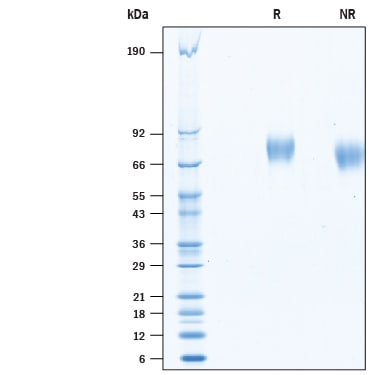 Recombinant Human Axl His-tag Protein SDS-PAGE