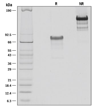 Recombinant Mouse PD-L1/B7-H1 Fc Chimera Protein SDS-PAGE