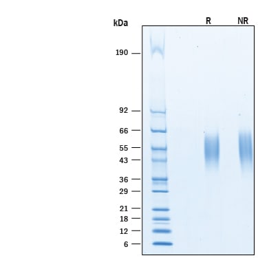 Recombinant Human B7-1/CD80 His-tag Avi-tag Protein SDS-PAGE