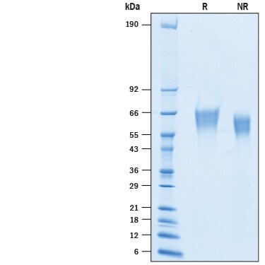 Recombinant Cynomolgus Monkey B7-2/CD86 His-tag Protein SDS-PAGE