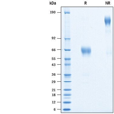 Recombinant Human B7-H2 Isoform 3 Fc Avi-tag Protein SDS-PAGE