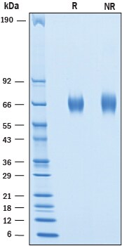 Recombinant Cynomolgus B7-H7/HHLA2 His-tag Protein SDS-PAGE