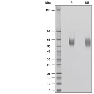 Recombinant Human B7-H7/HHLA2 His-tag Protein SDS-PAGE