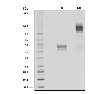 B8R Inhibits IFN-gamma Activity.