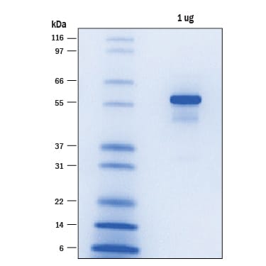 Recombinant Human His8-(DYKDDDDK)-BRD4 (49-460) Protein SDS-PAGE