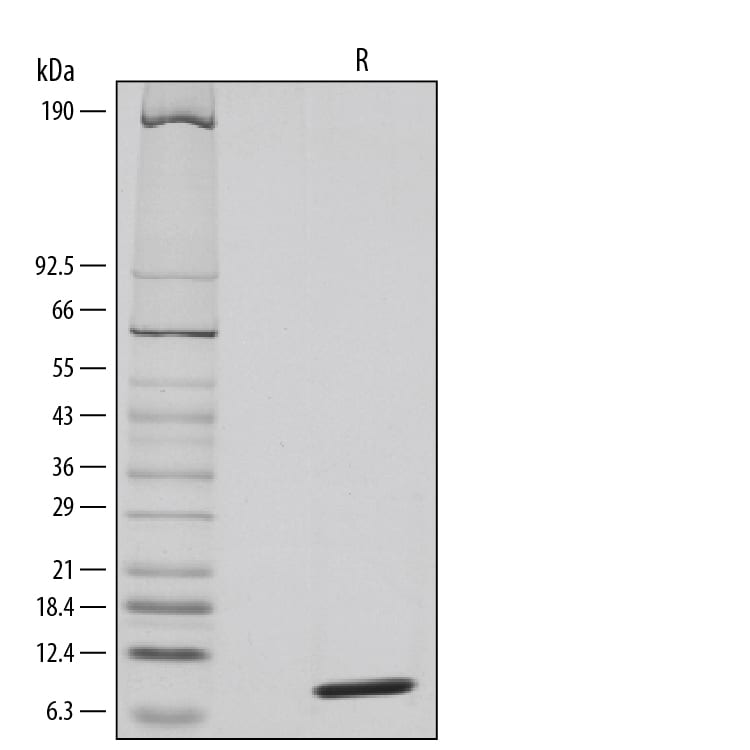 Recombinant Human CCL20/MIP-3 alpha Protein SDS-PAGE
