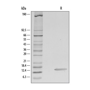 Recombinant Human CCL28 Protein SDS-PAGE
