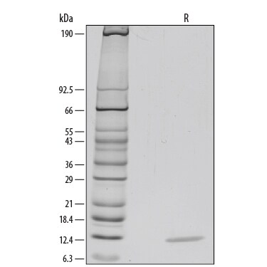 Recombinant Human CCL3/MIP-1 alpha Protein SDS-PAGE