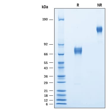 Recombinant Mouse CD200R1L Fc Chimera Protein SDS-PAGE
