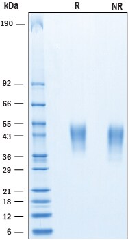 Recombinant Human CD200 His-tag Protein SDS-PAGE