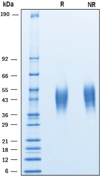 Recombinant Cynomolgus Monkey CD200 His-tag Protein SDS-PAGE