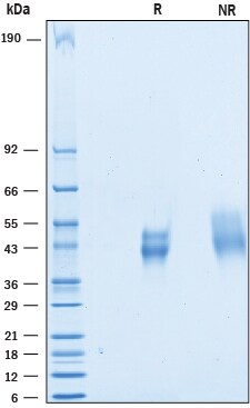 Recombinant Mouse CD200 His Tagged Protein SDS-PAGE