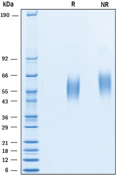 Recombinant Human CD200R1 His-tag Protein SDS-PAGE