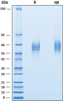 Recombinant Mouse CD200R1 His-tag Protein SDS-PAGE