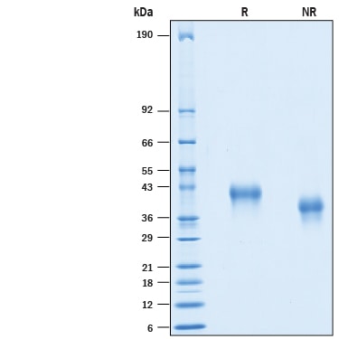 Recombinant Human CD25/IL-2R alpha His-tag Protein SDS-PAGE