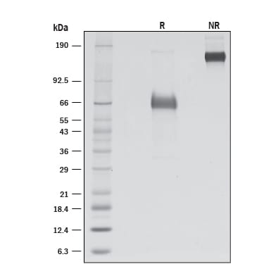 Recombinant Human CD2F-10/SLAMF9 Fc Chimera Protein SDS-PAGE