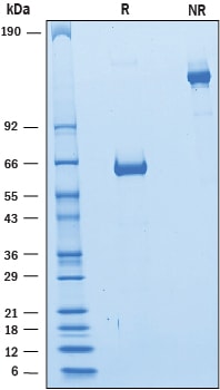 Recombinant Human CD2 Fc Chimera Protein SDS-PAGE