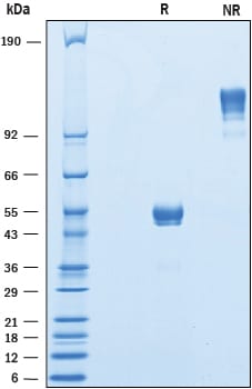 Recombinant Human CD300b/LMIR5 Fc Chimera Protein SDS-PAGE