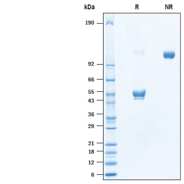 Recombinant Human CD300e/LMIR6 Fc Chimera Protein SDS-PAGE