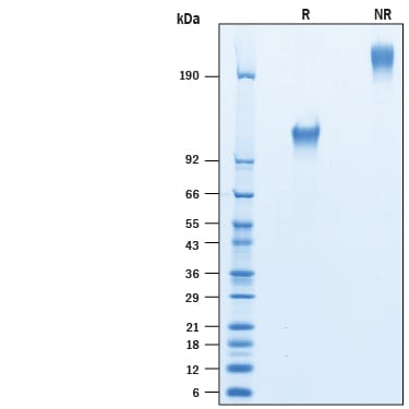Recombinant Human CD30/TNFRSF8 Fc Avi-tag Protein SDS-PAGE