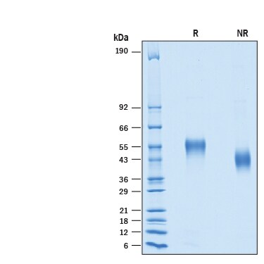 Recombinant Human DGCR2 His-tag Protein SDS-PAGE