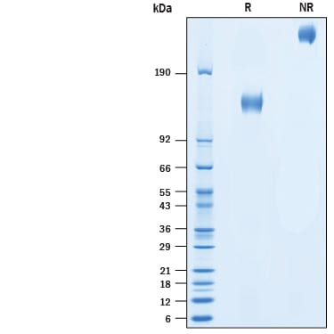 Recombinant Human CD45RB Fc Chimera Protein SDS-PAGE