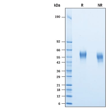Recombinant Human CD46 His-tag Protein SDS-PAGE