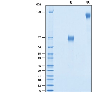 Recombinant Human CD46 Fc Chimera Protein SDS-PAGE