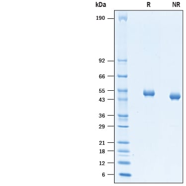 Recombinant Human CD4 Protein SDS-PAGE