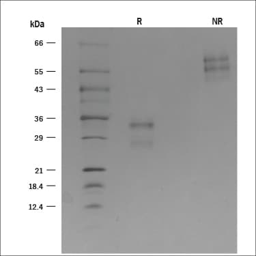 Recombinant Mouse CD69 Protein SDS-PAGE