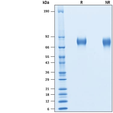 Recombinant Cynomolgus CD6 His-tag Protein SDS-PAGE