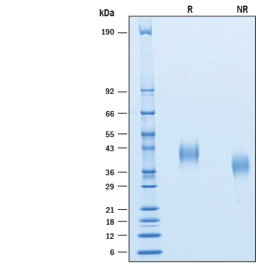 Recombinant Cynomolgus Monkey CD7 His-tag Protein SDS-PAGE