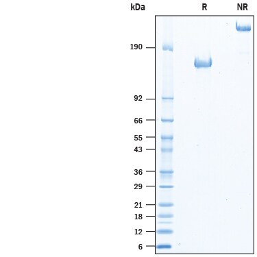 Recombinant Mouse CD96 Protein Fc Chimera SDS-PAGE