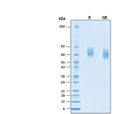 Recombinant Human CD97 His-tag Protein SDS-PAGE